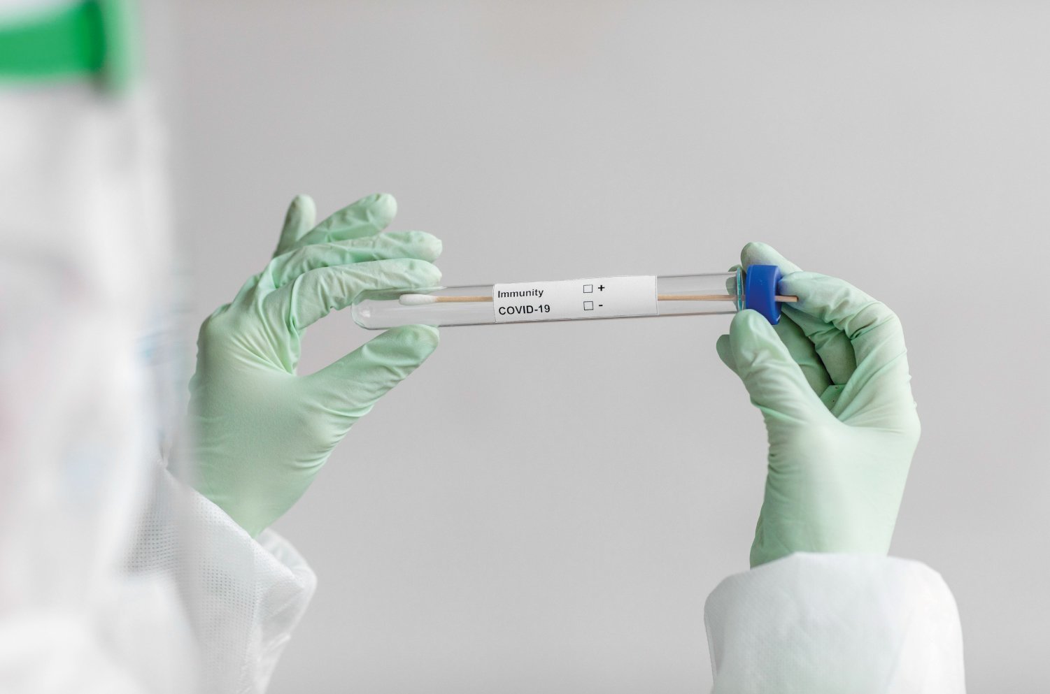 PCR - Antigen-Schnelltest 
